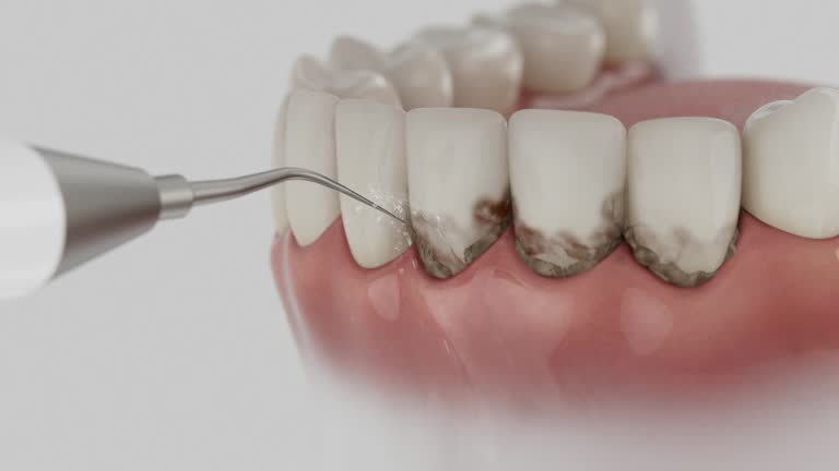 Trusted Dental Crowns And Bridges service in Marcus Hook, PA - Dentist Open Now